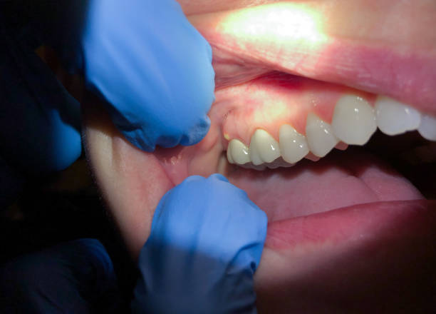  Fourche Crossing, LA Emergency Dentist Pros